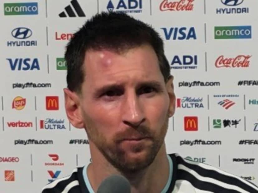 El tremendo chichón con el que terminó Messi el partido ante Cabo Verde