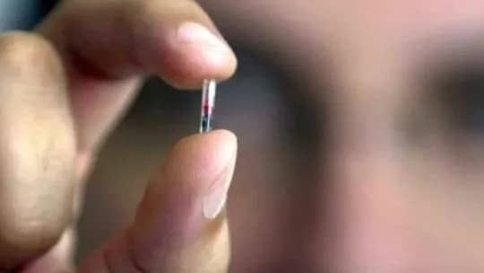 Niñas de 11 años y anticonceptivos: qué dice la ley sobre el acceso a un "Chip Sexual"