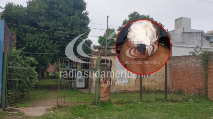 Corrientes: brutal ataque a un jubilado durante un intento de robo