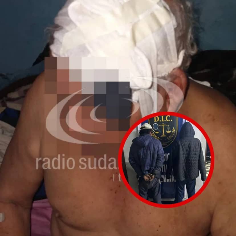 Detuvieron a dos hombres por el brutal ataque a jubilado de 72 años
