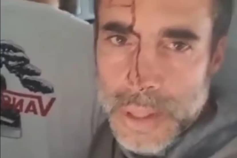 Pasajeros israelíes relatan el caos a bordo de un vuelo entre Dubai y Tel Aviv