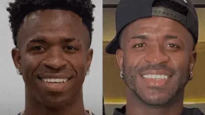 Los detalles de la operación estética de Vinicius tras el Mundial 2026 - TyC Sports