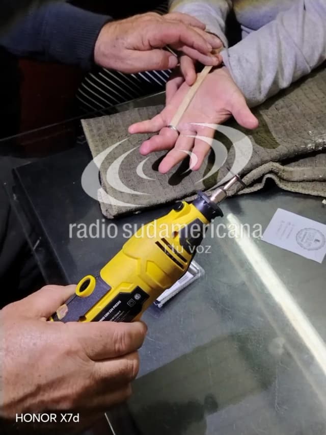 Se le inflamó el dedo y tuvieron que cortarle el anillo en un cuartel