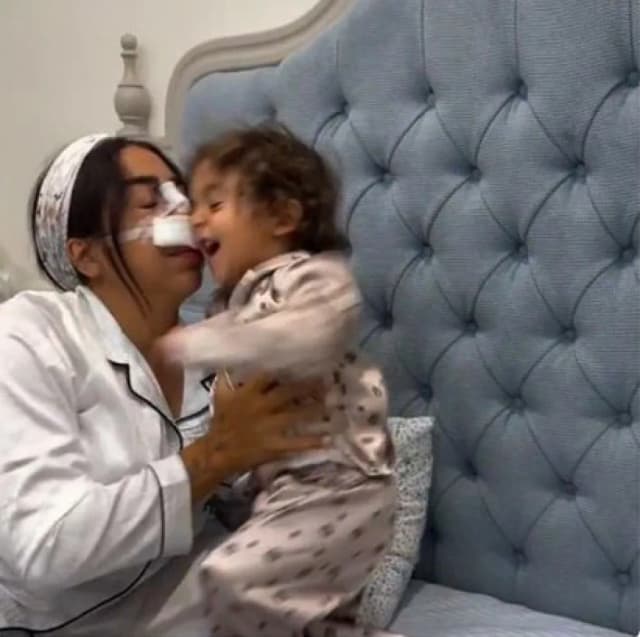 Niña golpea la nariz recién operada de su madre y la obliga a repetir cirugía