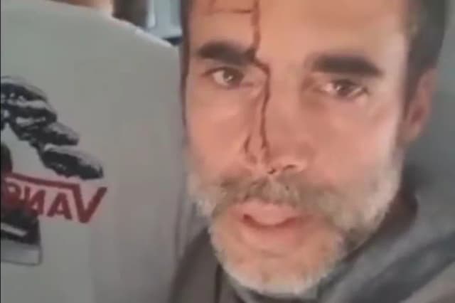Pasajeros israelíes relatan el caos a bordo de un vuelo entre Dubai y Tel Aviv