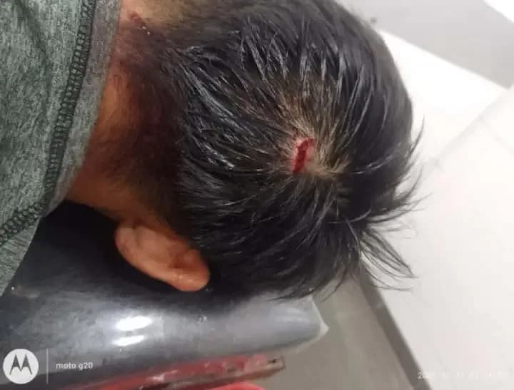 Fallido robo: noqueó a un ladrón y lo hirieron al escapar