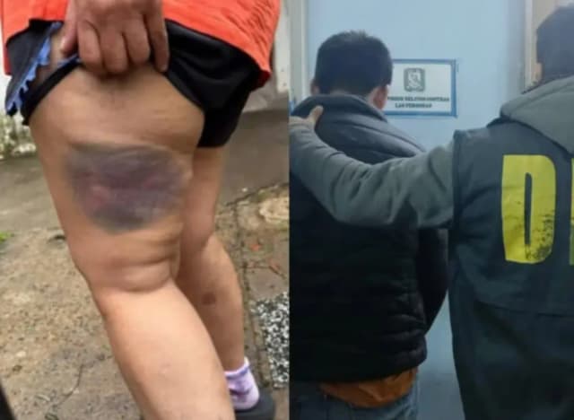 Atacó a su ex pareja con un garrote y fue detenido en Chaco