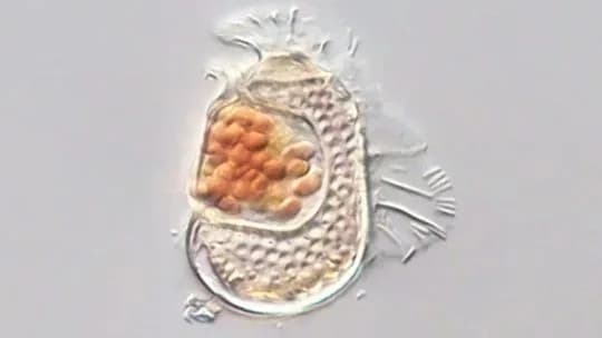 Descubrieron un microorganismo que desafía la frontera entre lo vivo y lo no vivo