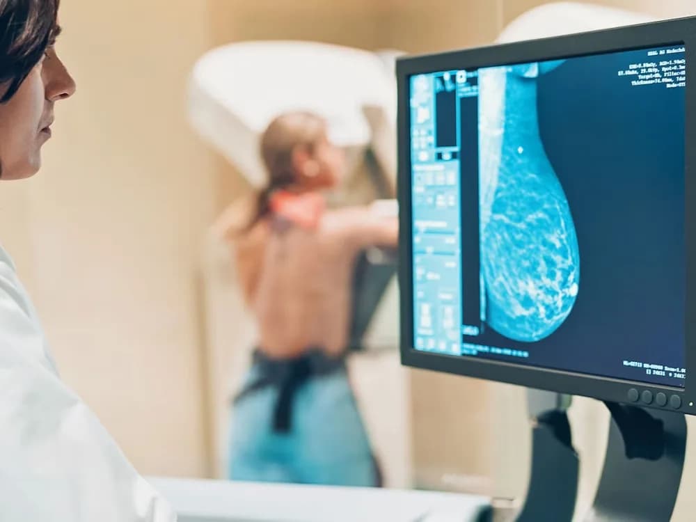 Cáncer de mamas: dónde hacerse una mamografía en Corrientes