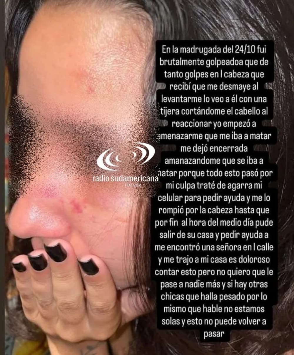 Portada de video: El estremecedor relato de una joven que acusó a su novio de intentar prenderle fuego