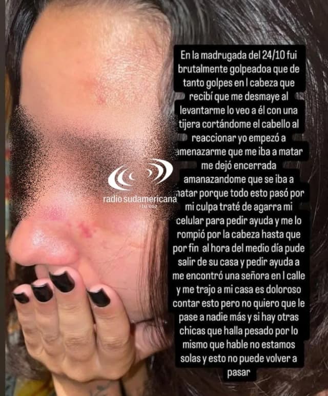 El estremecedor relato de una joven que acusó a su novio de intentar prenderle fuego