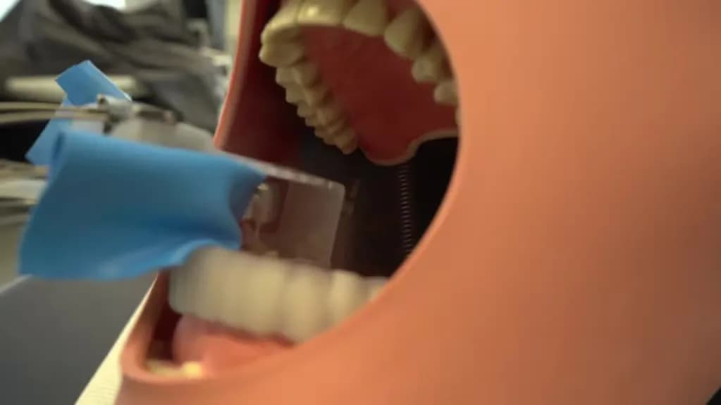 Así es el robot que asiste a los dentistas: “Cabe en la boca del paciente”