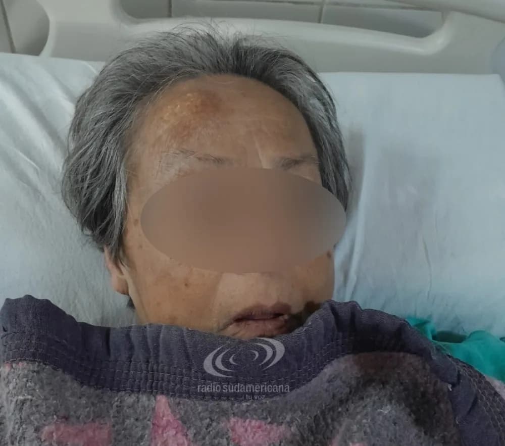 Apareció una sobrina de la mujer que está internada en el Escuela