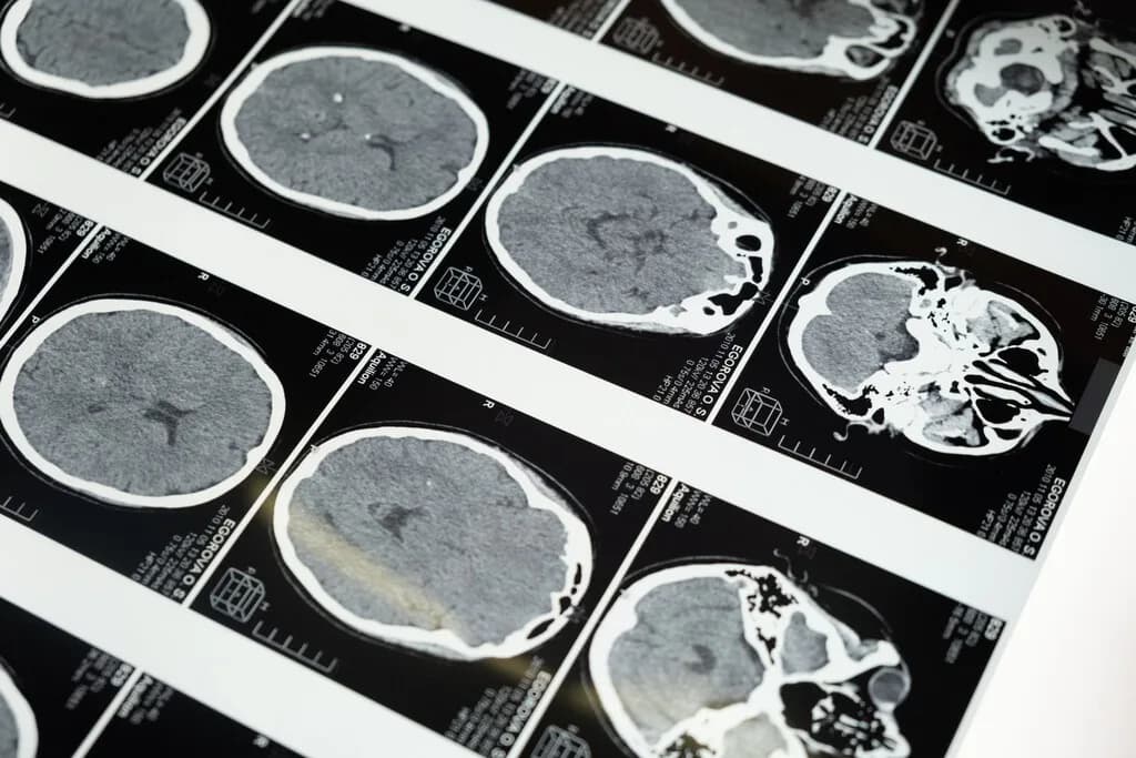 No es solo cuestión de cumplir años: la mala salud metabólica envejece tu cerebro por una vía completamente independiente