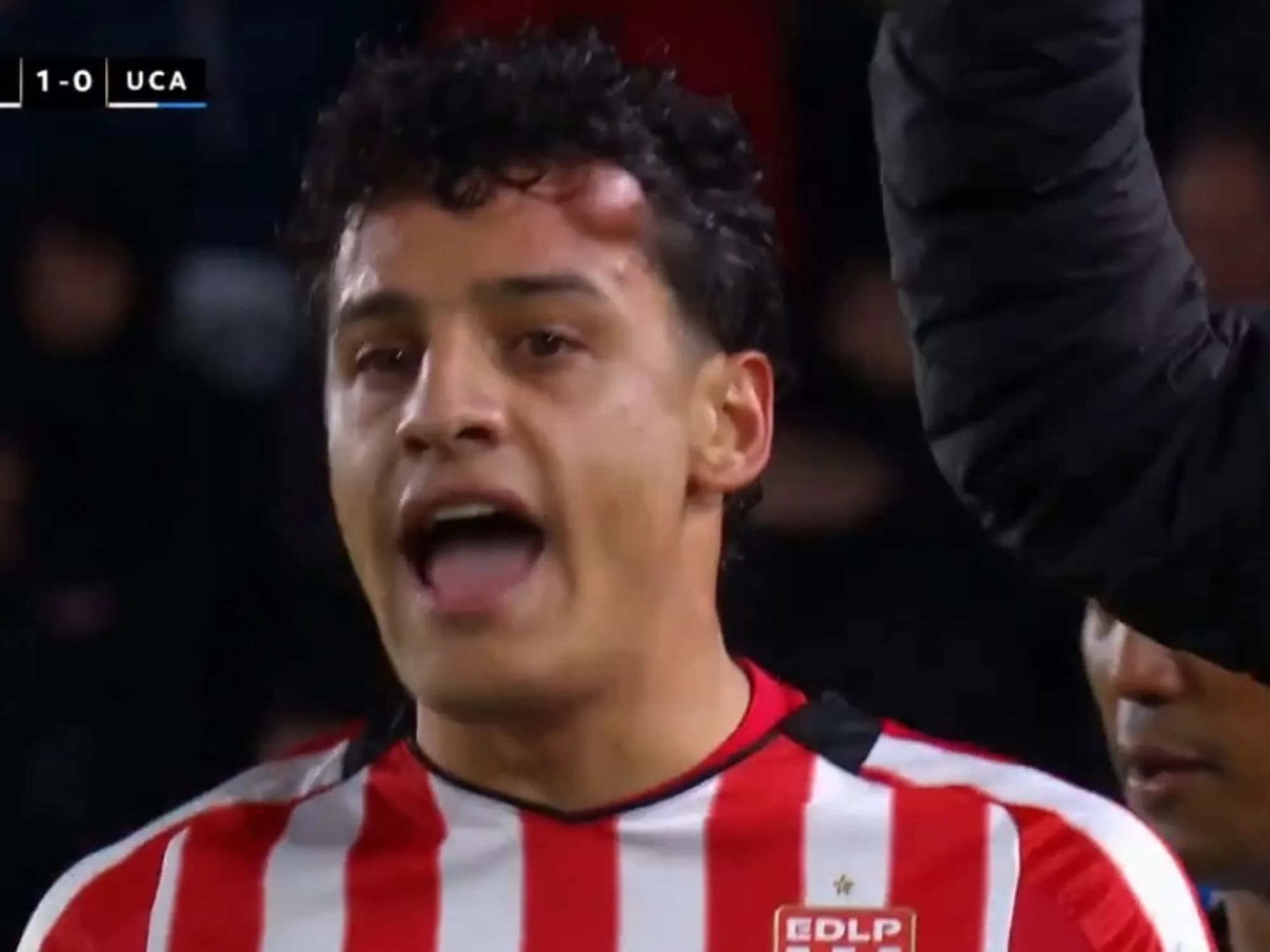 Video: el impresionante chichón que ligó Tiago Palacios en Estudiantes