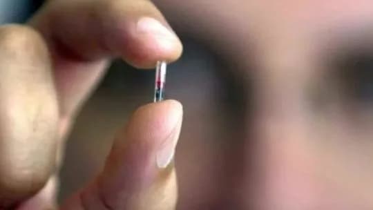 Niñas de 11 años y anticonceptivos: qué dice la ley sobre el acceso a un "Chip Sexual"