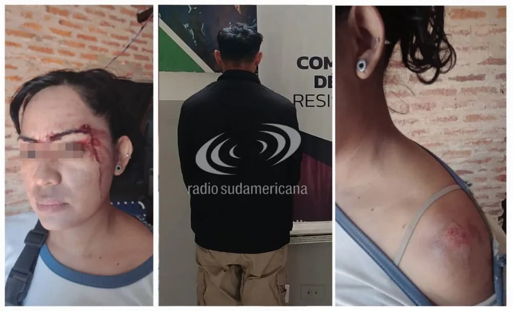 Chaco: encontró a su ex pareja en la calle y la chocó con su camioneta