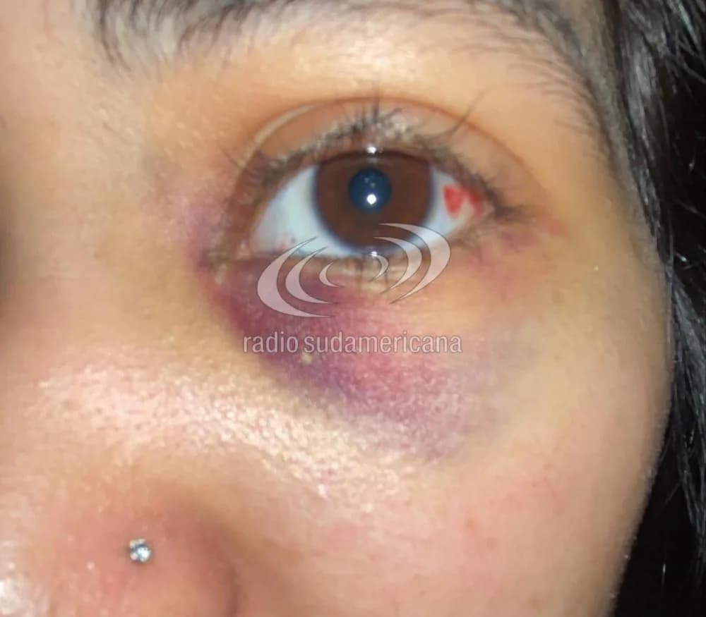 Portada de video: Denunció que su compañera la noqueó en el patio de la Escuela
