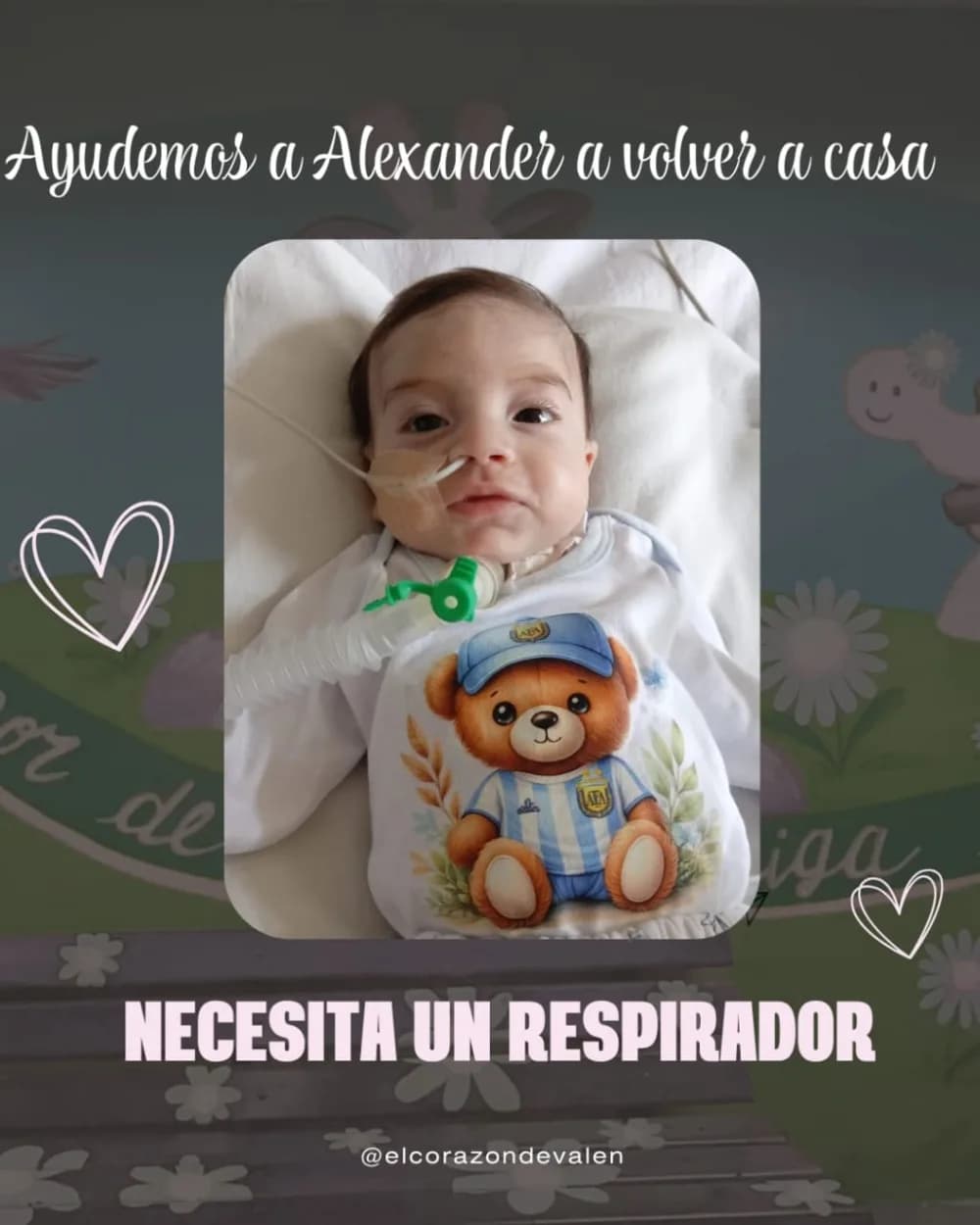 Alexander necesita un respirador y otros insumos para poder volver a su casa