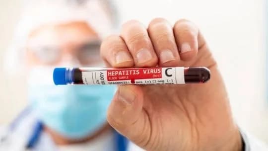 Hepatitis C en Argentina: reportan entre 700 y 800 casos al año y advierten sobre el diagnóstico tardío