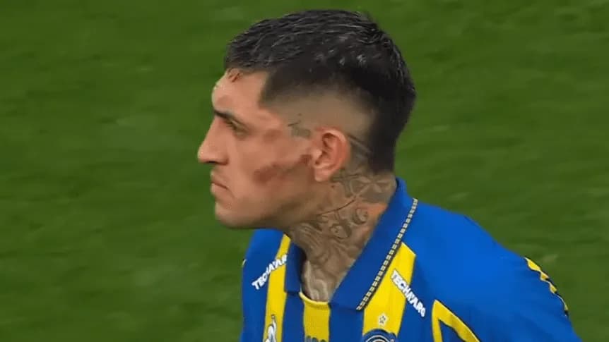 Gastón Ávila fue hospitalizado tras la patada de Álex Arce: el parte médico de Rosario Central - TyC Sports